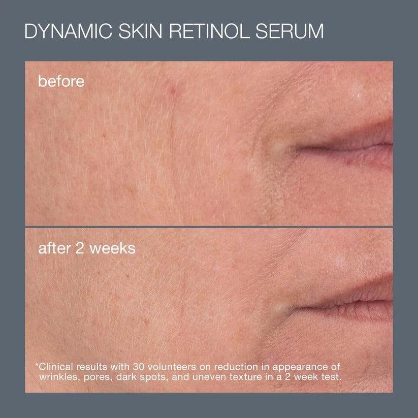 Skin Ageing Solutions Set