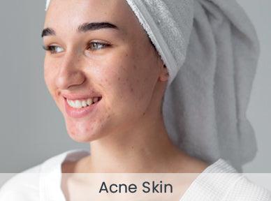 files/Webstore_Main-Page_388px-x-288px_Skin-Concern1_Acne-Skin.jpg