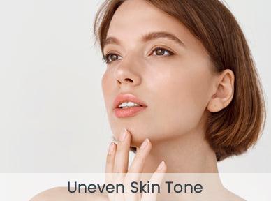 files/Webstore_Main-Page_388px-x-288px_Skin-Concern6_Uneven-Skin-Tone.jpg