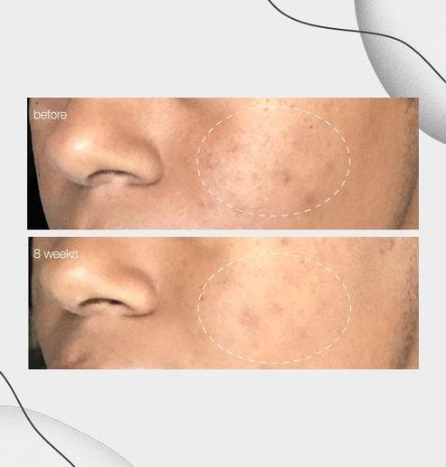 PowerBright Dark Spot Serum