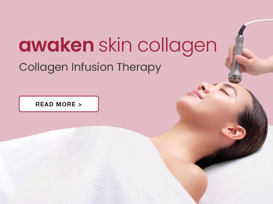 Collagen Infusion Therapy