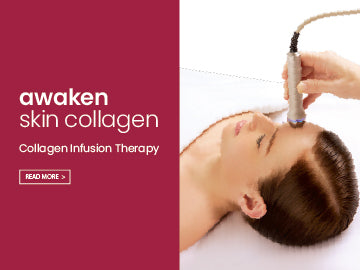 Collagen Infusion Therapy