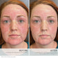 HydroPure™ Color Correcting Serum with Hyaluronic Acid & CoQ10