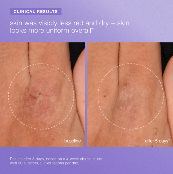 Stabilizing Repair Serum