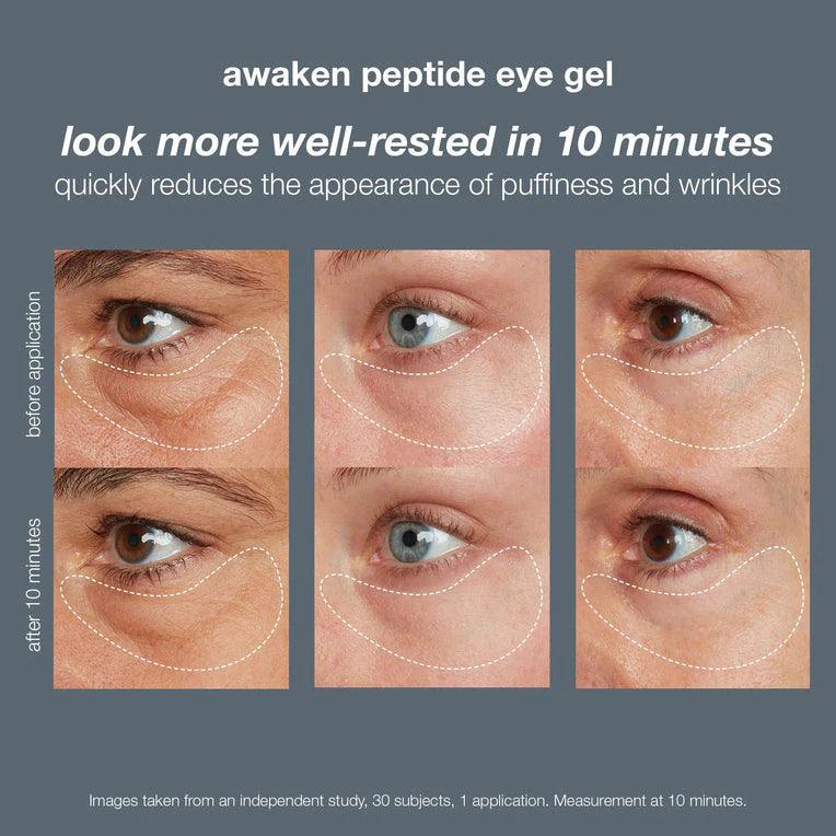 Awaken Peptide Eye Gel - AsterSpring Malaysia